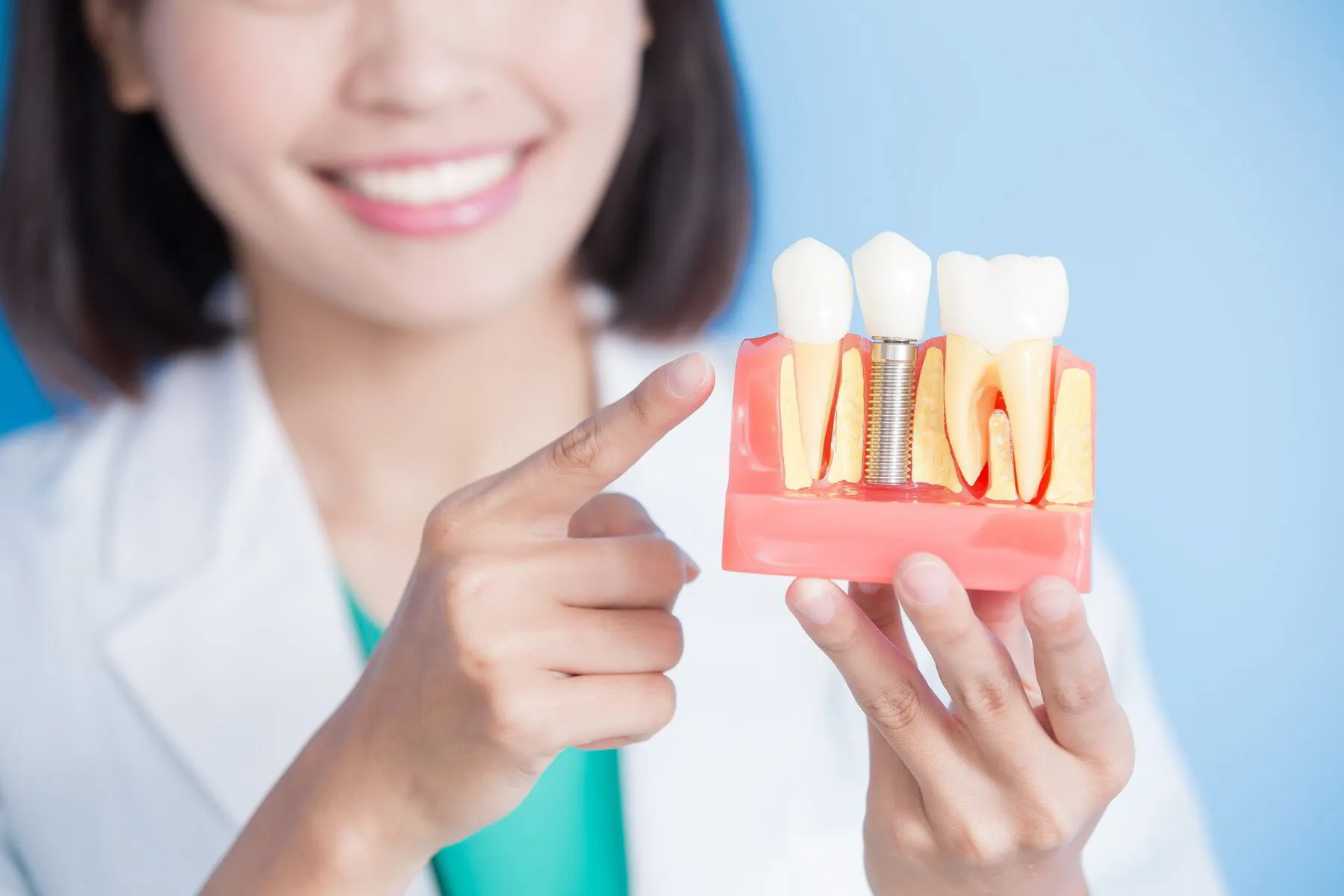 Dentist holding a dental implant model to explain tooth replacement treatment
