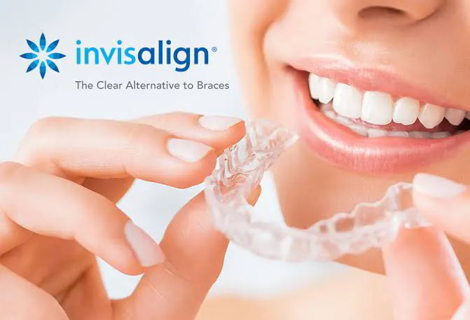 Invisalign clear aligner being placed over teeth for discreet orthodontic treatment