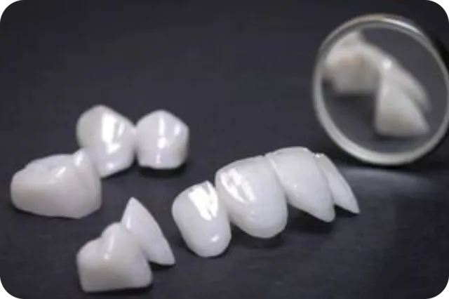 Dental crowns and bridges for damaged or missing teeth