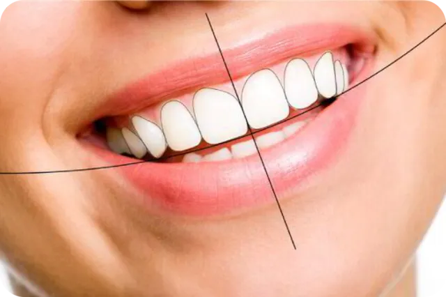 Cosmetic smile makeover treatment in Bengaluru